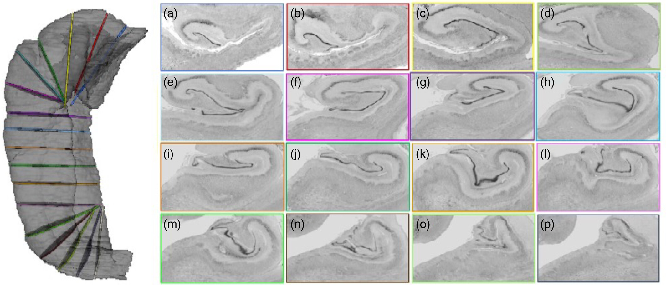 Figure for Curved Multiplanar Reformatting Allows the Accurate Histological Delineation of Hippocampal Subfields.